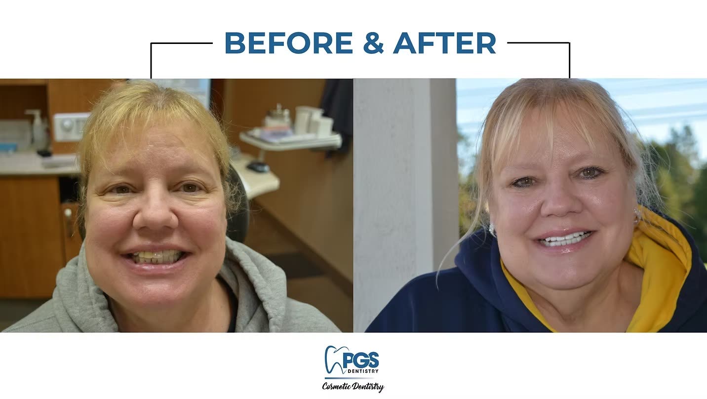 Real PGS Dentistry before and after